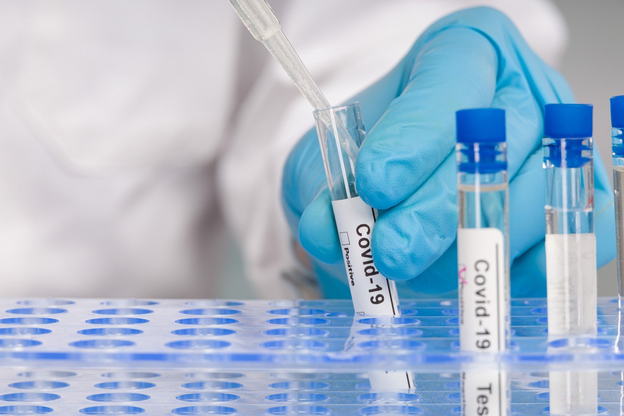 hand in blue gloves working with test tubes at virus analysis in a medical lab end to pre-departure testing